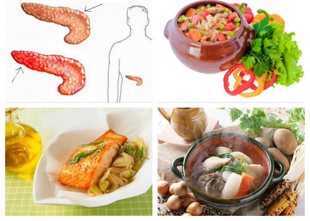 Dieta para pancreatite